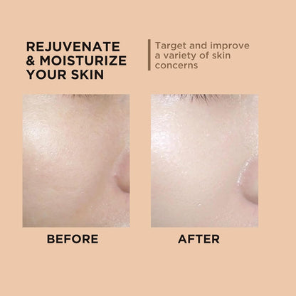 Facial Oxygen Spray Machine