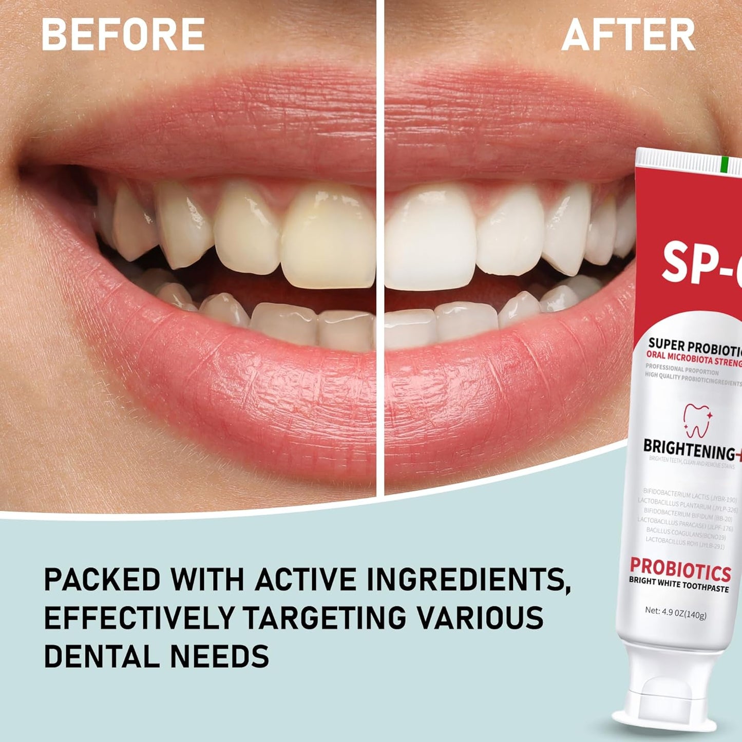 SP-6 Probiotic Whitening Toothpaste (2-pack)